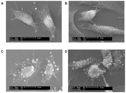 Figure 2 Scanning electron microscope images (scale bar = 10 μm) after the adhesion of calcium oxalate dihydrate with African green monkey kidney epithelial cells in the control group at (A) 2 hours, (B) 6 hours, (C) 12 hours, and (D) 24 hours.