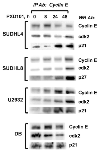 Figure 8. PXD101 induces association of CKI with cyclin E/cdk2 in resistant DLBCL cell lines. Whole cell extracts from cells treated with PXD101 for 0, 8, 24, and 48 h were used to perform immunoprecipitation with cyclin E antibody. Bound fractions were subjected to western blotting with antibodies against cyclin E and cdk2, and either p21 or p27. The results shown are representative of 3–4 independent experiments.