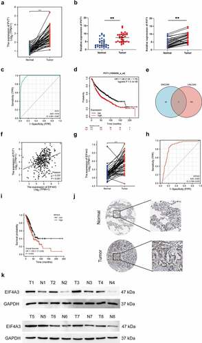 Figure 1. PVT1 and EIF4A3 were upregulated in LUAD. (a) The relative expression of PVT1 was analyzed in paired LUAD tumor samples (n = 57). *** p < 0.001. (b) The relative expression of PVT1 was analyzed in collected LUAD tumor samples (n = 32). ** p < 0.01. (c) The diagnostic value of PVT1 for LUAD was shown by ROC curve (AUC = 0.974, CI = 0.961–0.987). (d) The overall survival of lung cancer patients with PVT1 expression was analyzed by Kaplan-Meier plotter. (e) The intersection of PVT1 RNA-binding proteins predicted by ENCORI and associated proteins by UALCAN. (f) The correlation between PVT1 and EIF4A3 was analyzed by Pearson analysis. r = 0.337, P < 0.001. (g) The relative expression of EIF4A3 was analyzed in paired LUAD tumor samples (n = 57). *** p < 0.001. (h) The representative images of EIF4A3 expressing in lung cancer was obtained from human protein atlas. (i) The protein level of EIF4A3 was detected randomly in collected samples by western blot. (j) The diagnostic value of EIF4A3 for LUAD was analyzed using ROC curve (AUC = 0.832, CI = 0.788–0.876). (k) The overall survival analysis of lung cancer patients with EIF4A3 expression.