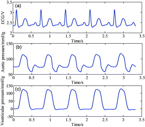 Figure 5. Synchronous ECG signal (a) and corresponding ventricular pressure (b).