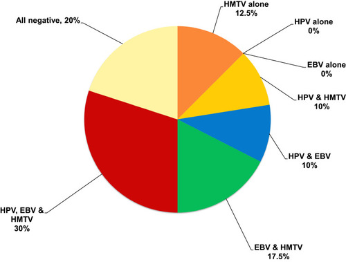 Figure 1 Detection of single and multiple HPV, EBV and HMTV infection among 40 BC fresh tissue samples. HPV/EBV/HMTV together found in 30%, followed by EBV/HMTV in 17.5%, HPV/HMTV in 10%, and HPV/EBV in 10%. HMTV DNA was the only virus present alone in 12.5% of BC fresh tissues.
