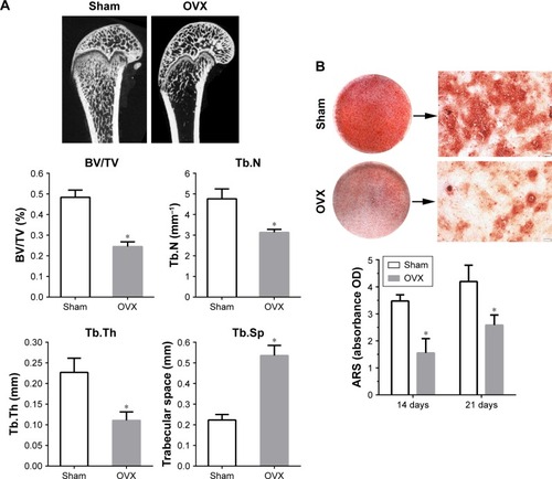 Figure 4 Establishment of OVX model.Notes: (A) Micro-CT images of distal femoral shafts in Sham and OVX rats, and the morphometric analysis of the bone volume fraction (BV/TV), Tb.N, Tb.Th, and Tb.Sp in femoral shafts between Sham and OVX groups (n=5 per group). (B) Alizarin Red staining for Sham and OVX rats-derived BMSCs after culturing in osteogenic medium for 21 days, and the quantitative analysis of mineralized nodules between Sham and OVX groups at days 14 and 21. Statistical significance is indicated by *p<0.05 compared to Sham group. Magnification: 40×. Scale bar: 200 μm.Abbreviations: ARS, Alizarin Red S; BMSC, bone marrow stromal stem cells; BV, bone volume; micro-CT, micro-computed tomography; OVX, ovariectomy; Tb.N, trabecular number; Tb.Sp, trabecular separation; Tb.Th, trabecular thickness; TV, tissue volume.