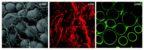 Figure 1. Peri-adipocyte collagens. Left: the scanning electron micrograph of mouse inguinal fat pads; the group of round adipocytes are surrounded with collagen bundles. Middle: immunofluorescent staining of type I collagen (red); thick bundles of type I collagen surrounding the group of adipocytes as well as thinner fibers of type I collagen enwrapping individual adipocyte is displayed. Right: immunofluorescent staining of type IV collagen (green); type IV collagen is found as a component of basement membrane that enwraps each adipocytes; type IV collagen can also be found as the basement membrane underneath the layer of vascular endothelial cells.