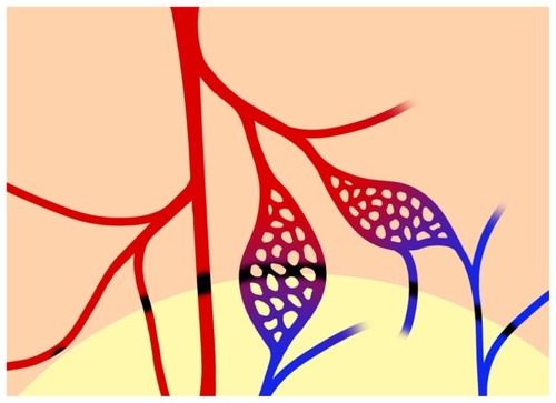 Figure 7 Schematic diagram of MNP retention along the edge of the magnet.Notes: From left to right, MNP retention may occur in the lumen of the 2nd arteries, the major artery (in red), the capillaries, and the venules (in blue) in the cremaster muscle preparation. MNP deposit (in black) may occur at the margin of the magnet, which may completely or partially block flow in the microvessels. The lower part of the figure with the light background indicates the location of a neodymium magnet underneath the muscle layer.