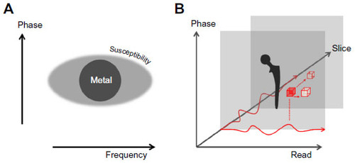 Figure 3 Diagrammatic representation of how the frequency encoding direction is more sensitive to susceptibility artifacts than the phase encoding direction (A). High field gradients distort the assumed linearity of the frequency encoding gradient, which means that within a plane, signal is misattributed from one voxel to another (B). This means that one voxel has signal removed, causing a signal void (red voxel), and another has its signal enhanced (white voxel), resulting in signal pile-up or hyperintensities. Frequency gradients are also applied in the slice select direction so that misregistration also occurs between slices.