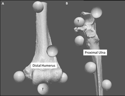 Figure 1. Fiducial configuration. (A) Four fiducial markers were attached to the humerus, two medially and two laterally, both proximally and distally around the joint articulation. A fifth fiducial was positioned on the articulation (region of interest) to measure TRE. (B) Four fiducial markers were attached to the ulna, one on the olecranon, one on the coronoid, and two distal markers on the medial and lateral side. A fifth fiducial was also positioned on the greater sigmoid notch (area of interest) to measure TRE.