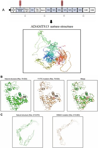 Figure 4. Domain organization and 3D model of ADAMTS13. (A). Schematic representation of ADAMTS13 protein domain and the location of the ADAMTS13 mutations. (B). Models of the wild type of ADAMTS13 protein and the Y177C mutation (residues 70–533 were modeled). (C) Models of the wild type of ADAMTS13 protein (residues 615–970 were modeled) and the truncated mutation (residues 615–883 were modeled).