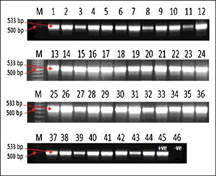 Figure 2. Agarose gel electrophoresis showing the mecA gene.