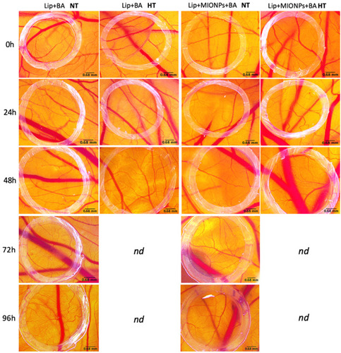 Figure 11 Stereomicroscopic in vivo images of the vascularized areas treated with liposomal samples containing BA (Lip+BA and Lip+MIONPs*CA+BA) at concentration of 25 µM, under normothermic - NT (37 °C) and hyperthermic pre-treatment - HT (46 °C). The specimens with hyperthermic pre-treatment died after 48h, so they were not determined (nd) further. Three independent experiments were performed for each sample (n=3).