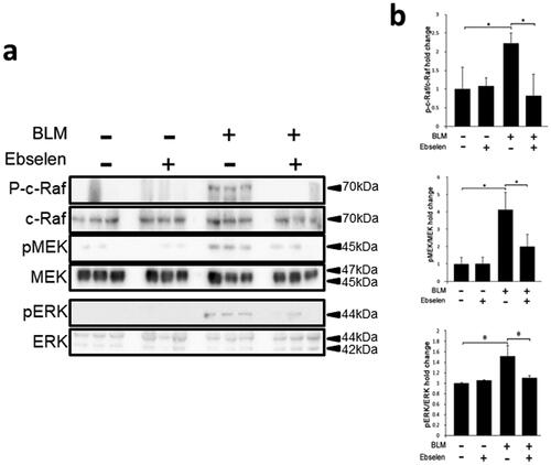 Figure 6. Effect of ebselen on MAPK pathway activation. (a) Western blot analysis was performed with MAPK (c-Raf, MEK and ERK) phospho-specific antibodies. (b) Measurement of band intensity. Phosphorylation of MAPK was significantly increased by BLM administration and suppressed by ebselen treatment. P < 0.05 denotes a statistically significant difference. BLM: bleomycin; MAPK: mitogen-activated protein kinase; ERK: extracellular signal-regulated kinase; MEK: MAPK/ERK kinase.