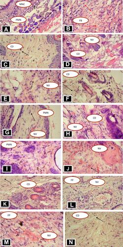 Figure 1 Photomicrographs of skin tissue (H and E x40) of crude and solvent fraction ointment treated mice in excision and burn wound models. (A) Mice treated with Negative control in excision wound model, (B) mice treated with 5% extract in excision wound, (C) mice treated with 10% extract in excision model, (D) mice treated with Nitrofurazone in excision wound, (E) mice treated with negative control in burn wound, (F) mice treated with 5% in burn, (G) mice treated with 10% extract in burn wound, (H) mice treated with positive control in burn, (I) mice treated with negative control in fractions, (J) Mice treated with Ethyl acetate fraction 5%, (K) mice treated with Ethyl acetate fraction 10% (L) mice treated with 5% aqueous fraction, (M) mice treated with 10% aqueous fractions, (N) mice treated with positive control in fractions.