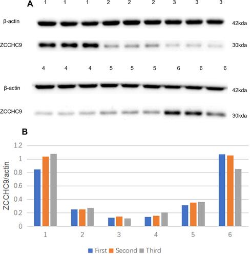 Figure 3 ZCCHC9 gene protein expression level. 1, 2, and 3 represent the AMI samples, and 4, 5, and 6 represent the stable CAD samples. Protein expression profiles (A) and relative experession level (B) of related genes. 