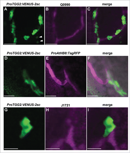 Figure 2. Myrosin cells and vascular precursor cells differ in spatial pattern and cell shape at an early stage of differentiation. Fluorescent images of myrosin cells (green; [A], [D], and [G]) and vascular precursor cells (magenta; [B], [E], and [H]), and their merged images ([C], [F], and [I]) at future secondary veins in a juvenile leaf at DAG4 or DAG5 in plants that express a myrosin cell marker (ProTGG2:VENUS-2sc) and each of the 3 vascular precursor cell markers: Q0990 (B), ProAtHB8:TagRFP (E), and J1721 (H). Arrowheads in (A) indicate stomata. Bars = 50 μm in (A) to (C), and 20 μm in (D) to (I).