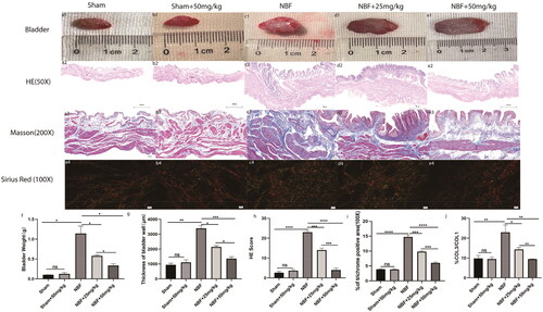 Figure 4. Staining of bladder tissue sections in each group. (a1–e1) represent the general condition of the bladder in the sham group, sham + ABT-263 group (50 mg/kg), NBF group, NBF + ABT-263 group (25 mg/kg), and NBF + ABT-263 group (50 mg/kg), respectively. (a2–e2) represents the matoxylin and eosin (HE) staining of the bladder in each group. (a3–e3) represent Masson staining of each bladder. a4–e4 represents Sirius red staining of the bladder in each group. (f) Statistical histogram of bladder weight in each group, which shows that bladder fibrosis was basically normal in the sham group and sham + ABT-263 group (50 mg/kg), the most serious in the NBF group, slightly improved in the NBF + ABT-263 group (25 mg/kg), and greatly improved in the NBF + ABT-263 group (50 mg/kg). (g) Statistics of the bladder HE staining score in each group histogram, which showed that bladder inflammation was basically normal in the sham and sham + ABT-263 (50 mg/kg) groups, the most serious in the NBF group, slightly improved in the NBF + ABT-263 group (25 mg/kg), and greatly improved in the NBF + ABT-263 group (50 mg/kg). (h) Statistical histogram of bladder fibrosis area in each group, which shows that bladder fibrosis was basically normal in the sham and sham + ABT-263 (50 mg/kg) groups, the most serious in the NBF group, slightly improved in the NBF + ABT-263 group (25 mg/kg), and greatly improved in the NBF + ABT-263 group (50 mg/kg). j: Statistical histogram of the Col3/Col1 ratios for each group. HE Scale bar = 200 μm. Masson Scale bar = 50 μm. Sirius red Scalebar = 100 μm. Data are expressed as the mean ± SEM; ns p > 0.5, *p < 0.01, **p < 0.001, ***p < 0. 0001. All experiments were repeated three times.
