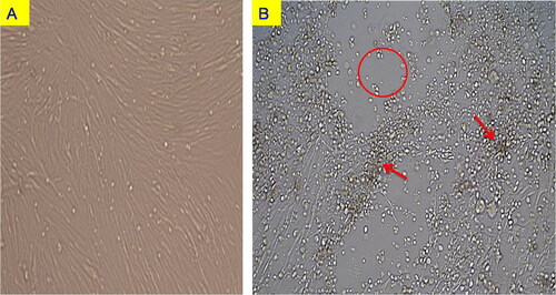 Figure 1. Cytopathic effects in the virus infected CEF cell culture. (A) Control CEF cell monolayer; (B) CEF cell culture infected with DEV at 41st passage, showing characteristic cytopathic effects like rounding of cells, syncytia formation, aggregation of cells resembling bunch of grapes, detachment of cells from the surface forming more gaps in the monolayer.