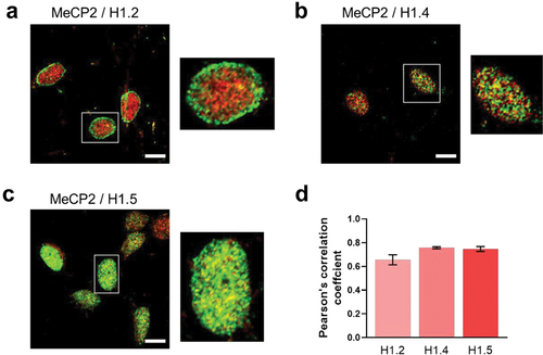 Figure 7. Histone H1 isoform/MeCP2 co-localization. (a) histone H1.2; (b) histone H1.4; (c) histone H1.5. Magnified images for the insets shown in the white rectangles are also provided. (d) quantification of the histone H1 isoform/MeCP2 co-localization using the Pearson’s correlation coefficient (n = 6). Scale bar: 10 µm.