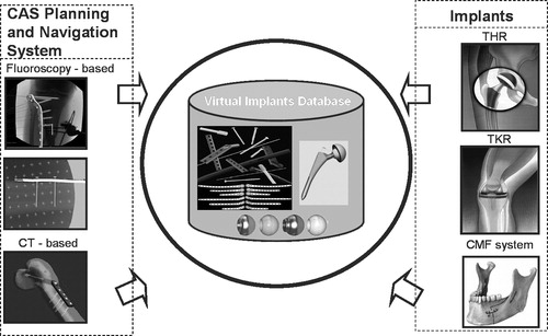 Figure 1. Virtual implant database: system overview. Various implant types and CAS systems are supported. (color version available online)