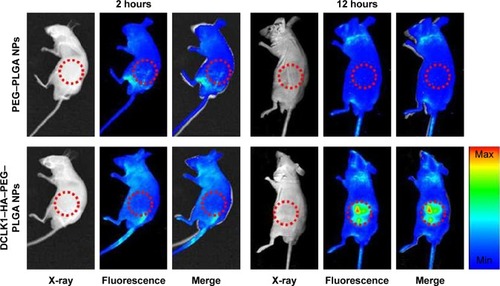 Figure 7 Detection of the targeting abilities of NPs in vivo.Notes: The R6G–PEG–PLGA and R6G–DCLK1–HA–PEG–PLGA NPs were prepared and intravenously injected into the nude mice. The image was recorded by an in vivo imaging system.Abbreviations: DCLK1, doublecortin-like kinase 1; HA, hyaluronic acid; NPs, nanoparticles; PEG, poly(ethylene glycol); PLGA, poly(d,l-lactide-co-glycolide); R6G, rhodamine 6G.