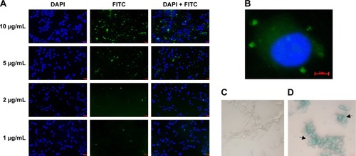 Figure 3 In vitro cellular uptake studies (n = 3).Notes: (A) Fluorescent images of FITC-labeled PLGA-NPs at different concentrations of PTX (1–10 μg/mL) after 1 h of incubation. (B) FITC green fluorescence around the blue color of DAPI-stained nuclei clearly exhibited the uptake of FITC-labeled PLGA-NPs. (C) Prussian blue staining of untreated cells (control). (D) Prussian blue staining of internalized SPIO-NPs (80 μg/mL Fe). The blue color of cells is due to a chemical reaction occurring between internalized iron and Prussian blue stain. PLGA-NPs, PLGA-based NPs; SPIO-NPs, SPIO-loaded NPs.Abbreviations: FITC, fluorescein isothiocyanate; NPs, nanoparticles; PLGA, poly(lactic-co-glycolic acid); PTX, paclitaxel; SPIO, super paramagnetic iron oxide.