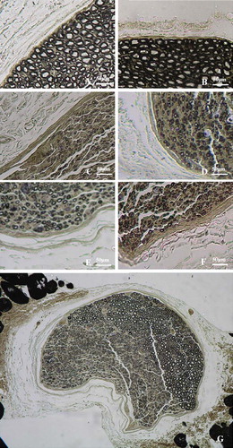 Figure 2. Histological sections through the reconstructed nerves 4 months after surgery. Proximal part of the median nerve (A) and ulnar nerve (B). Distal stump of transected median (C, Dor-Dor, Group 2) or ulnar (D, Dor-Dor Group 3) nerve neurorrhaphy; Distal regenerated median (E) and ulnar (F) stump of the group (1/2Dor-1/2Dor+Rec Group 4) in which half proximal median proximal median nerve was served as donor nerve to reconstruct the distal 1/2 median and ulnar nerve stump. (G) Distal stump of the reconstructed median nerve. Both regenerated fibers and original intact fibers could be observed.