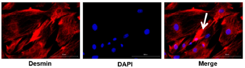 Figure 6. Identification of primary hepatic stellate cells in mice with hepatic stellate cells. (Polygonal pseudopodia marked with arrow could be observed in some hepatic stellate cells.).