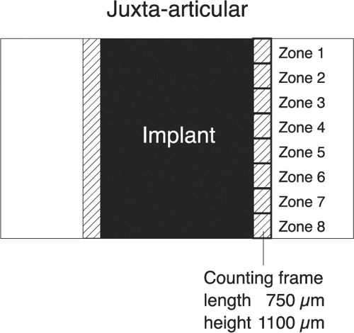 Figure 4. This simplified diagram shows a histological section with an implant. The counting frame is moved stepwise from the juxta-articular tip of the implant to the base of the implant, thus dividing the peri-implant area into eight zones. The initial peri-implant gap around the implant is indicated.