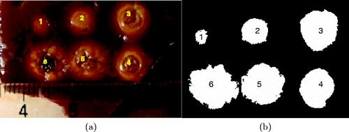 Figure 4. (a) Six lesions generated in bovine liver using laser with different heating time. The degree of tissue whitening is related to the severity of thermal damage and is used to produce the damage areas (A1–A6) in (b).