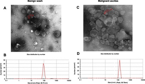 Figure 1 Characterization of EVs from peritoneal washes and malignant ascites. (A and C) EVs as observed by TEM. (B and D) Size distribution as measured with a Malvern Zetasizer Nano ZS90. Each experiment was replicated at least 3 times with similar results.Abbreviations: EVs, extracellular vesicles; TEM, transmission electron microscopy.