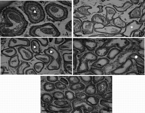 Figure 4.  Representative photographs of the epididymis sections from the control, diabetic, and α-mangostin treated diabetic rats stained with hematoxylin and eosin (scale bar: 50µm). A) Epididymis of control rat showing normal epithelium and plenty of intact spermatozoa (▴) in lumen of epididymal tubule. B) Epididymis of diabetic rat showing damaged epithelial cells of tubules and loss of sperms (★). C) Epididymis of 25 mg/kg bw of α-mangostin treated diabetic rats showing improvement in sperm density (▶) and structural integrity. D) Epididymis of 50 mg/kg bw of α-mangostin treated diabetic rats showing nearly normal structure and sperm density. E) Epididymis of gliclazide treated diabetic rats showing normal structure of tubules filled with mature sperm (↑).