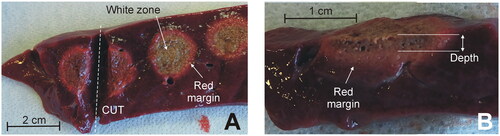 Figure 3. Examples of coagulations zones created with the Coolingbis® device on ex vivo samples. (A) Top view of the tissue surface (i.e., transection plane) showing circular coagulations zones created after moving the electrode during RF application. Only the whitish zone was considered in the measurement of the size, discarding the red margin. (B) Side view of the cut tissue. Depth was measured from the tissue surface.