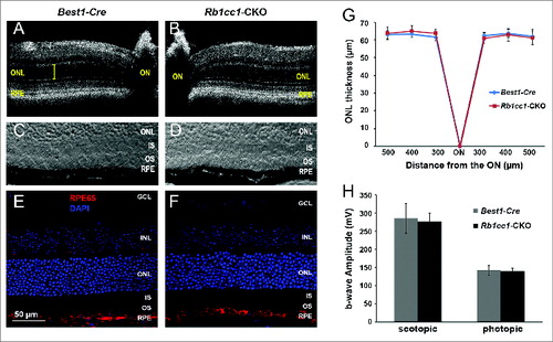 Figure 3. Retinal and RPE morphology are normal in Rb1cc1-CKO mice at 2 mo of age. (A–D) At the age of 2 mo, the outer retinas of the Rb1cc1-CKO and littermate controls were similar in appearance, as shown by OCT and DIC images of retina sections. (E, F) Immunostaining of RPE65 in Rb1cc1-CKO retina was identical to controls. (G) Quantification of outer nuclear layer thickness (yellow bar in [A]) of Rb1cc1-CKO and control mice measured with OCT. (H) Quantification of rod (scotopic) and cone (photopic) ERG showed no significant difference between Rb1cc1-CKO and control mice. GCL, ganglion cell layer; INL, inner nuclear layer; IS, inner segment; ONL, outer nuclear layer; OS, outer segment; RPE, retinal pigment epithelium.