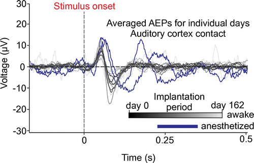 Figure 3. Summary of recording experiment for the second generation device (BrainInterchange). Gray-scaled traces represent the averaged AEP from individual recording days and one contact on the auditory cortex electrode array while the animal was awake (from black = day 0 to light-gray = day 162 after implantation) and blue traces represent measurement under general anesthesia (each measurement consisted of 121 to 300 trials). Dashed lines indicate the stimulus onset (vertical) and the zero potential (horizontal).