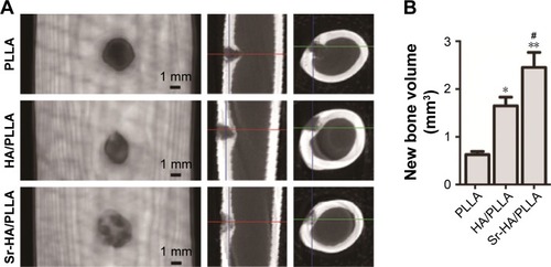 Figure 6 Micro-CT images and new bone volume of femur defects after 4 weeks’ implantation of different porous scaffolds in rabbits.Notes: (A) Micro-CT images of femur defects at 5 weeks after surgery. (B) New bone volume in the defects sites. **P < 0.01, *P < 0.05 vs PLLA, and #P < 0.05 indicated as Sr-HA/PLLA vs HA/PLLA.Abbreviations: micro-CT, micro computed tomography; PLLA, poly(l-lactic acid); Sr-HA/PLLA, strontium-doped hydroxyapatite on porous poly(l-lactic acid); HA/PLLA, hydroxyapatite on porous poly(l-lactic acid).