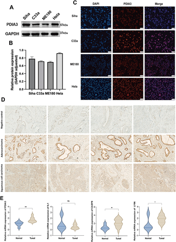 Figure 10 PDIA3 is highly expressed in cervical cancer (CC) tissues and cell lines. (A and B) Western blot analysis reveals a high expression of PDIA3 in CC cell lines. (C) Distribution of PDIA3 in CC cell lines. (D) Immunohistochemistry reveals PDIA3 expression in CC tissues, with normal cervical tissue serving as a positive control (200×). (E) IPGs mRNA expression relative to GAPDH in cervical cancer samples comparing (*p < 0.05, **p < 0.01, and ***p < 0.001).