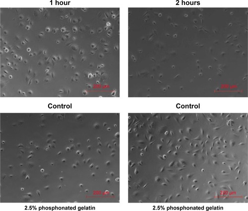 Figure 11 Micrographs of adhered cells on the phosphonated gelatin-coated titanium surface. Figure 12 Cell culture results on titanium surfaces treated with phosphonated gelatin.Notes: (A) Adhesion, (B) spreading, and (C) growth (after 4 days) of MC-3T3L1 cells on titanium surfaces treated with phosphonated gelatin. n=3, error bars indicate the standard deviation. **P<0.01.Display full size