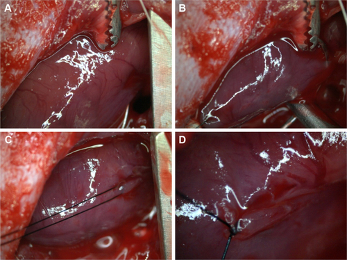 Figure S4 (A) Heart exposition of the coronary artery. (B–D) Ligation of the left coronary artery.