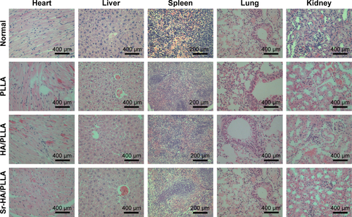 Figure S1 Histopathology of the heart, liver, spleen, lung, and kidney of mice.Abbreviations: PLLA, poly(l-lactic acid); HA/PLLA, hydroxyapatite on porous poly(l-lactic acid); Sr-HA/PLLA, strontium-doped hydroxyapatite on porous poly(l-lactic acid).