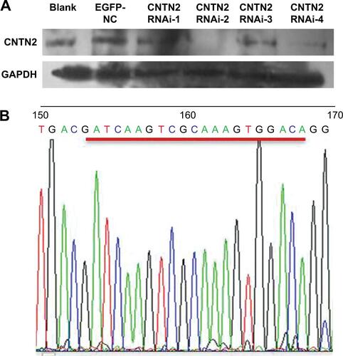 Figure S1 CNTN2 RNAi selection.Notes: (A) The Western blot shows that CNTN2 RNAi-2 was the most effective among the four RNAi vectors to inhibit CNTN2 expression in U87-GSCs. (B) Gene sequencing results of CNTN2 RNAi-2 after lentiviral infection of U87-GSCs.Abbreviations: CNTN2, contactin 2; RNAi, RNA interference; U87-GSCs, U87-derived glioma stem cells; GAPDH, glyceraldehyde 3-phosphate dehydrogenase.
