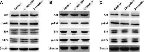 Figure 6 Effects of GLP-1R agonists on PI3K/Akt and MAPK/Erk signaling pathways in PTC cell lines.