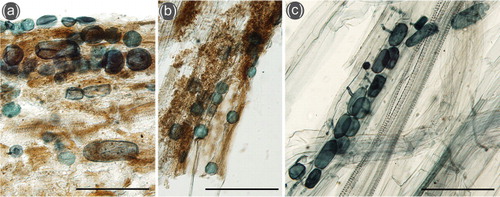 Fig. 7 Fungal structures of Olpidium in roots of Saxifraga oppositifolia sampled at (a) Ragnar 1 (closest to the glacier foreland) and (b) Ragnar 3 sampling sites, and (c) Braya purpurascens at the Ragnar 5 site. The scale bars are 100 µm.