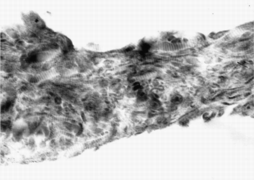 Figure 2. TEM of the collagen–HA composites (CH1).