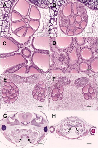 Figure 3. Morphologic variability of thyroid glands from AMA studies. (A, B) Thyroid glands of two control frogs from the same experiment (C and D are higher magnifications of A and B, respectively). While A was recorded as not remarkable, B displays mild follicular cell (FC) hypertrophy and mild FC hyperplasia. Note that despite the relative increase in cell proliferation, the overall gland size of B is actually smaller than A. The prevalence of mild to moderate FC hypertrophy may be as high as 100% in some control groups. (E, F) Variation in thyroid gland size, follicle size, and follicle shape in two control frogs from the same study. (G, H) Control and compound-exposed frogs, respectively, from the same study. Although the thyroids (arrows) in H are smaller than those of G, they are proportionally decreased in relation to body size, and therefore not necessarily atrophic. However, there does appear to be development delay in H compared to G, as evidenced by caudal migration of the thyroids and resorption of the internal gills in G. All images are hematoxylin and eosin. Bar sizes: A and B = 50 microns; C and D = 25 microns; E and F = 100 microns; G and H = 500 microns.