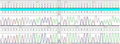 Figure 1(C). DNA sequencing analysis showing the missense mutation [β59(E3) Lys > Asn, HBB: c.180G > C].