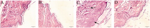 Figure 2. Cutaneous pathological changes of TCE-sensitized mice. (A) Blank control, (B) Vehicle control, (C) TCE+, and (D) TCE− mice. Black arrow shows epidermal thickening and keratinocyte edema in TCE-sensitized mice. Magnification 400×. Scale bars = 50 μm.