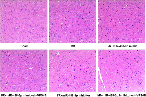 Figure 7 Impacts of miR-488-3p on cerebral morphological changes. Morphological detection by HE staining in groups of Sham, I/R, I/R + miR-488-3p mimic, I/R + miR-488-3p mimic + sh-VPS4B, I/R + miR-488-3p inhibitor, I/R +miR-488-3p inhibitor + sh-VPS4B (n=6).
