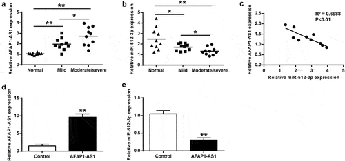 Figure 1. AFAP1-AS1 and miR-512-3p expression in osteoarthritis cartilage. (a) AFAP1-AS1 expression in normal cartilage and osteoarthritis cartilage. (b) MiR-512-3p expression in osteoarthritis cartilage and normal cartilage. (c) MiR-512-3p correlated with AFAP1-AS1 expression in osteoarthritis cartilage. (d) AFAP1-AS1 expression was measured in chondrocytes after treated with pcDNA-AFAP1-AS1. (e) AFAP1-AS1 overexpression inhibited miR-512-3p expression in chondrocytes. * P < 0.05, ** P < 0.01.