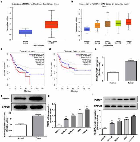 Figure 1. Upregulated PSMD7 expression level in gastric cancer tissues and cell lines. (a) Expression of PSMD7 in stomach adenocarcinoma (STAD) based on sample types, from UALCAN. (b) Expression of PSMD7 in STAD based on individual cancer stages, from UALCAN. (c) The correlation between PSMD7 expression and the overall survival of gastric cancer, analyzed by GEPIA. (d) The correlation between PSMD7 expression and the disease free survival of gastric cancer, analyzed by GEPIA. The mRNA (e) and protein expression (f) of PSMD7 in gastric cancer tissues and adjacent normal tissues, detected by Western blot. ***P < 0.001 vs Normal. (G&H) PSMD7 expression in human gastric mucosa cell line GES-1and human gastric cancer cell lines MKN-45, MKN-74, AGS and HGC-27, detected by qPCR and Western blot. **P < 0.01, ***P < 0.001 vs GES-1.