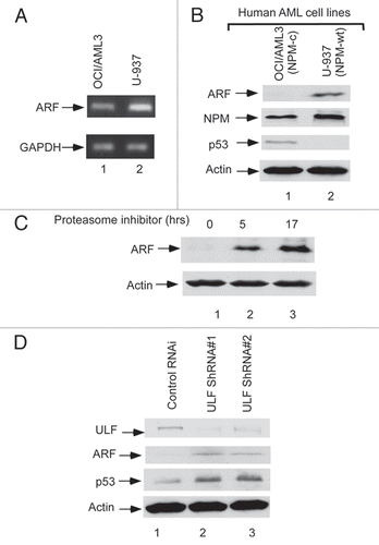 Figure 3 Inactivation of ULF reactivates the ARF-p53 axis in AML cells. (A) ARF mRNA expressions by RT-PCR from the cells in human AML NPM cytoplasmic mutant cell line (OCI/AML3) as well as wild type NPM cell line (U-937). (B) ARF protein level is low in OCI/AML3 (NPM-c) cells. Western blot analysis of cell extracts from OCI/AML3 (NPM-c) as well as U-937 (NPM-wt) with the antibodies against ARF, NPM, p53 and actin. (C) ARF expression levels are significantly increased in OCI/AML3 cells after proteasome inhibitor treatment. Western blot analysis of cell extracts from OCI/AML3, harvested at indicated time points (hr) after proteasome inhibitor treatment with an anti-ARF antibody. (D) Endogenous ULF was knocked down by pGPIZ lentiviral ULF ShRNAmir in OCI/AML3 cells. Western blot analysis of cell extracts of OCI/AML3 treated with a control ShRNAmir (lane 1), ULF ShRNA#1 (lane 2), ULF ShRNA#2 (lane 3) with the antibodies against ULF, p53, ARF and actin.
