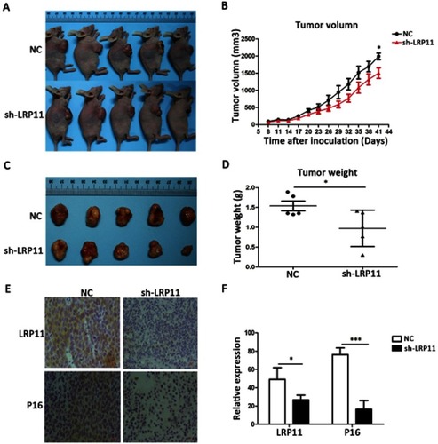 Figure 8 Effect of LRP11 sh-RNA on tumor growth in vivo. SiHa cells transduced with sh-LRP11 were subcutaneously injected into nude mice. (A and B) Tumor volumes were measured for 41 days. (C and D) At day 41, nude mice were sacrificed and the tumors were weighed. (E) LRP11 and P16 expression of the tumor in vivo by IHC. (F) H-Score of LRP11 and P16 in image E. *P<0.05, ***P<0.001 compared with the NC groups.