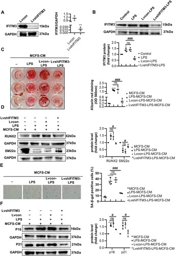 Figure 5. Knockdown of IFITM3 ameliorated calcification and senescence of VSMCs. (A) The knockdown of IFITM3 was confirmed by Western blot analysis. n = 3. (B) Western blot analysis was performed to assess the expression of IFITM3 in macrophages subjected to different interventions. n = 3. (C) AR staining and quantification were used to demonstrate that LvshIFITM3-LPS-MCFS-CM group attenuated VSMC calcification compared to LPS-MCFS-CM group. n = 3. (D) The expression of osteogenic markers (RUNX2, SM22α) in VSMCs was determined by Western blot analysis. n = 3. (E) Senescence in VSMCs was assessed by performing SA-β-gal staining and quantifying the percentage of positive cells. n = 3. Scale bar, 50 μm. (F) Western blot analysis was performed to assess the expression of senescent markers (p16 and p21) in VSMCs. n = 3. Data are presented as mean ± SD, two-tailed t-test (a), **p < 0.01 versus lvcon, one-way ANOVA (B, C, D, E, and F), *p < 0.05, ***p < 0.001, ****p < 0.0001 versus MCFS-CM, #p < 0.05, ###p < 0.001 versus LPS-MCFS-CM.